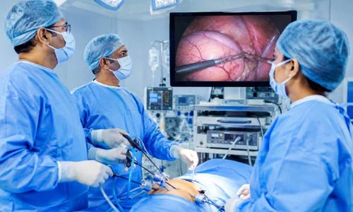 Complex Laparoscopy in Nagpur
