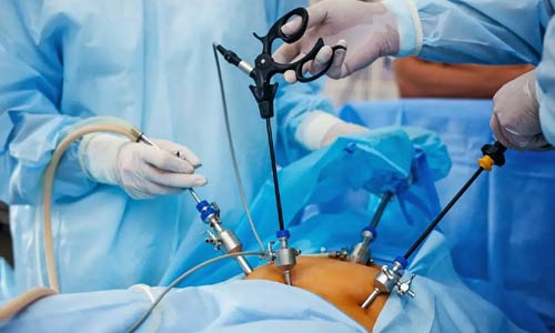 Minimally Invasive Surgery in Nagpur